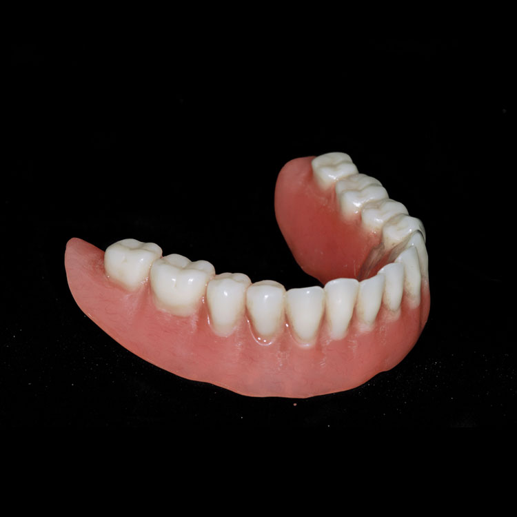 Full Arch Removable Implant Dentures